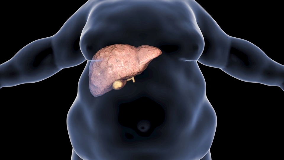Fatty Liver's Only Cure